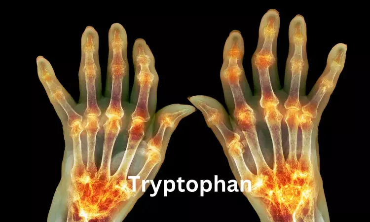 Altering Tryptophan metabolism may pave path for treating Rheumatoid arthritis