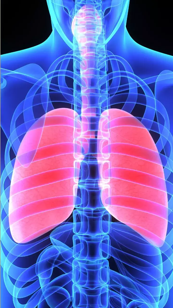 White Lung Syndrome: Symptoms, Causes, Prevention And Treatment