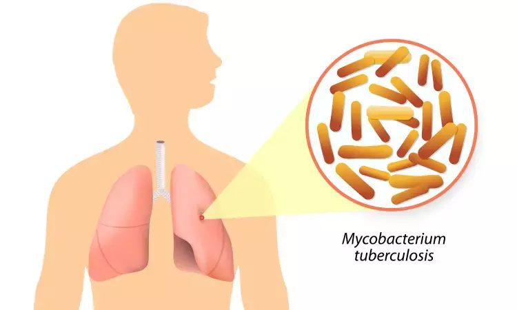 Increasing prevalence of TB-COVID Co-infection tied to increased mortality: Study