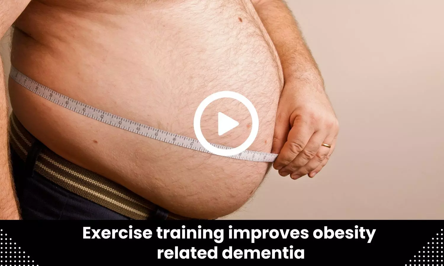 Exercise training improves obesity-related dementia