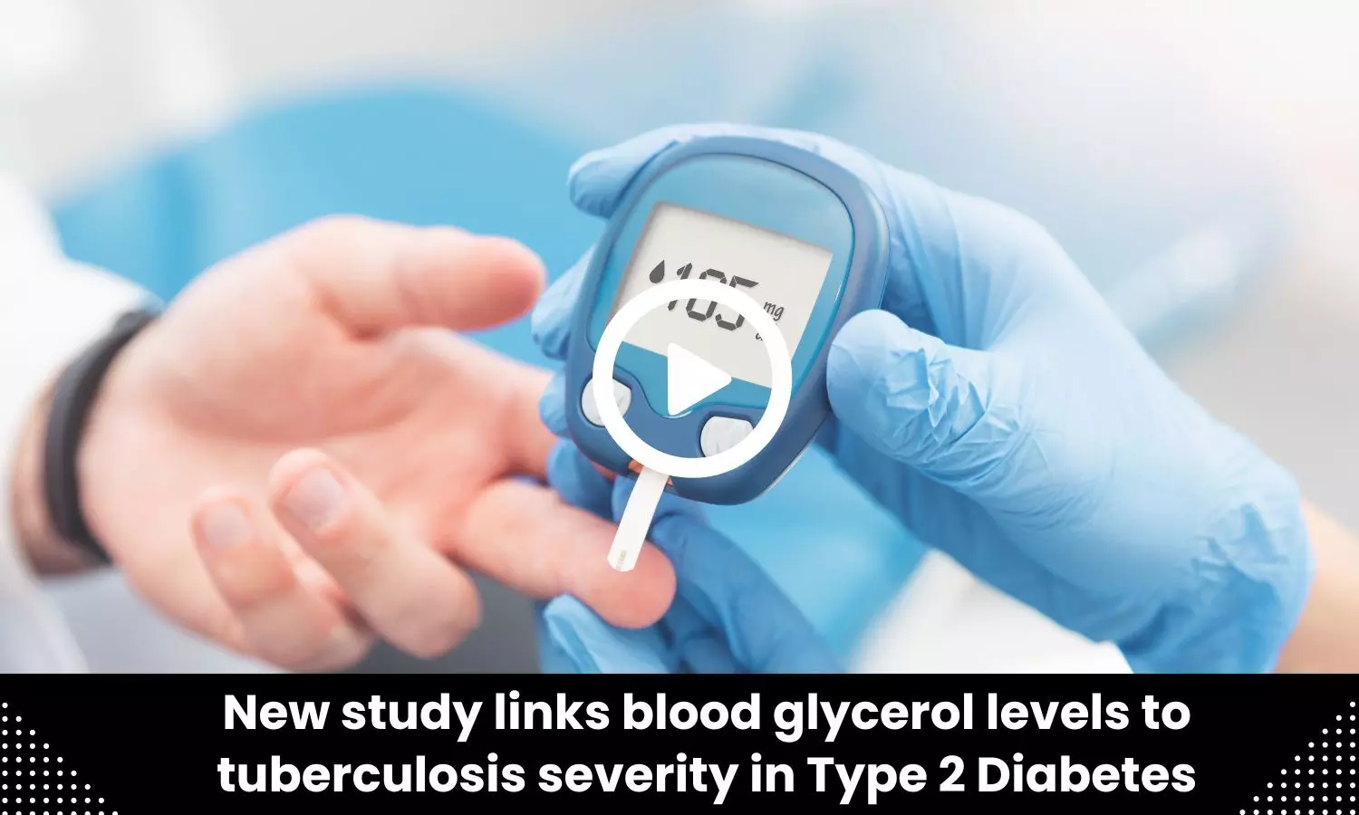 New study links blood glycerol levels to tuberculosis severity in Type 2 Diabetes
