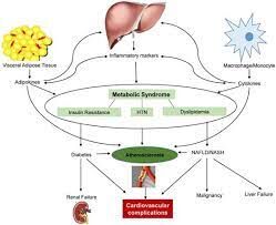 Cardiac insulin resistance may predict risk of metabolic syndrome and ...