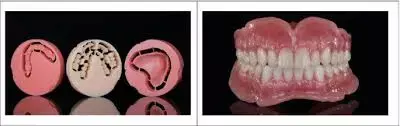 Both digital and conventional fabrication of complete dentures yield comparable clinical outcome