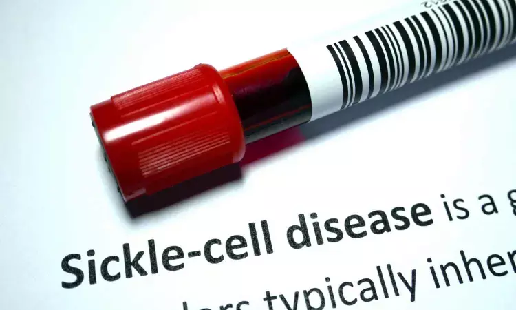 CKD increase mortality rate in patients with sickle cell disease: Study