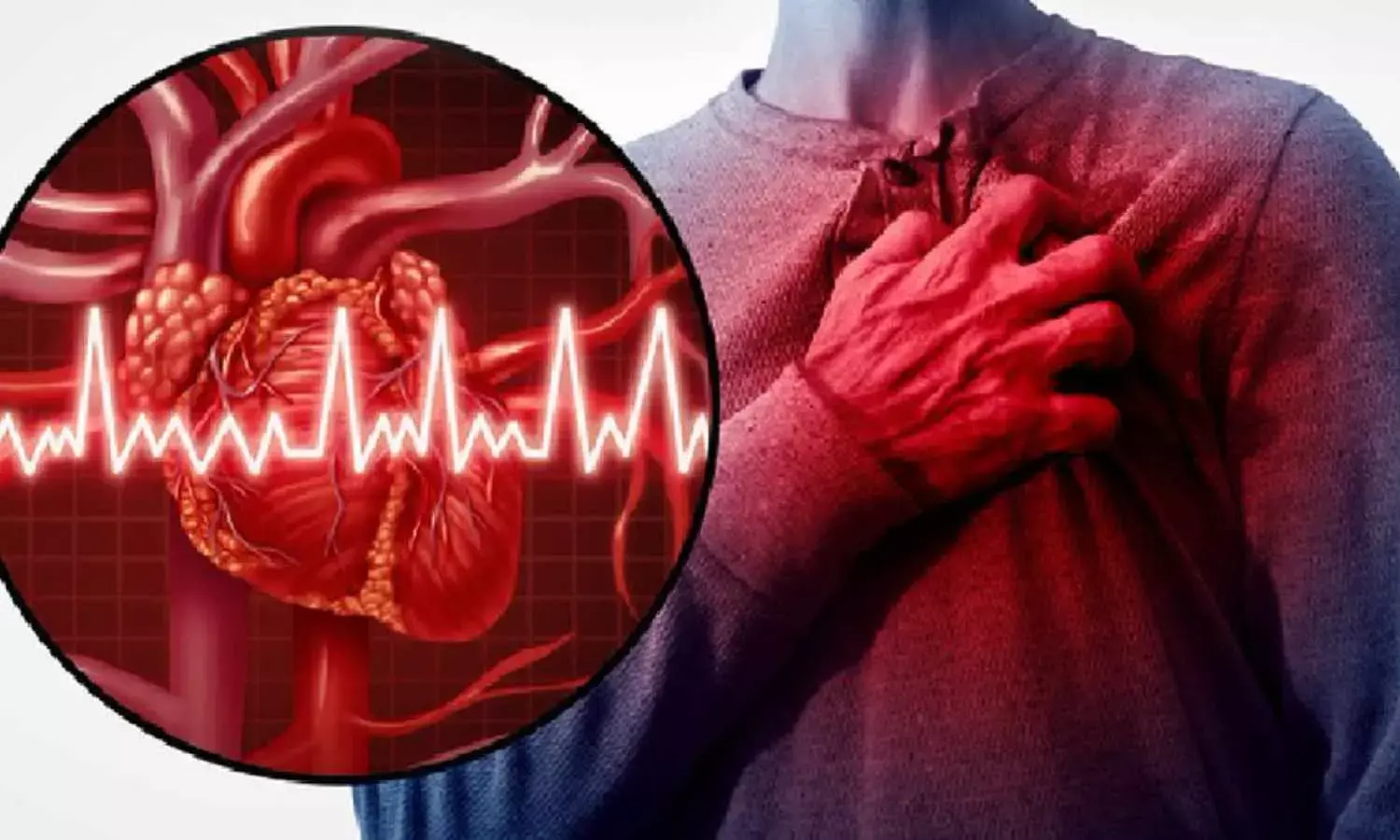 SGLT2 inhibitor empagliflozin  safe and effective for treating patients who have suffered MI: EMPACT-MI, ESC 2024