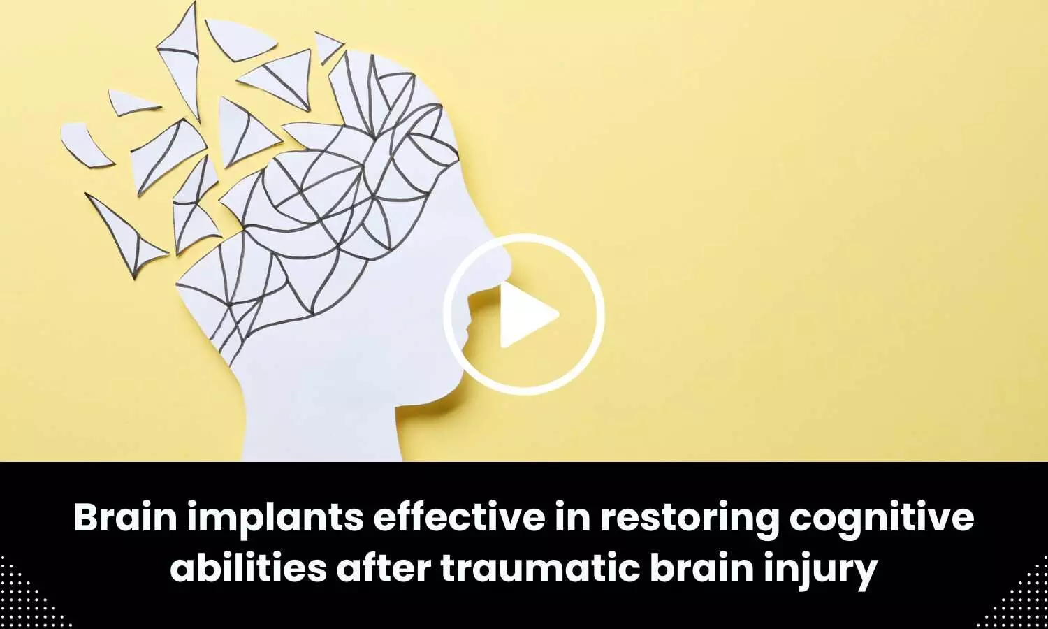 Brain implants effective in restoring cognitive abilities after traumatic brain injury