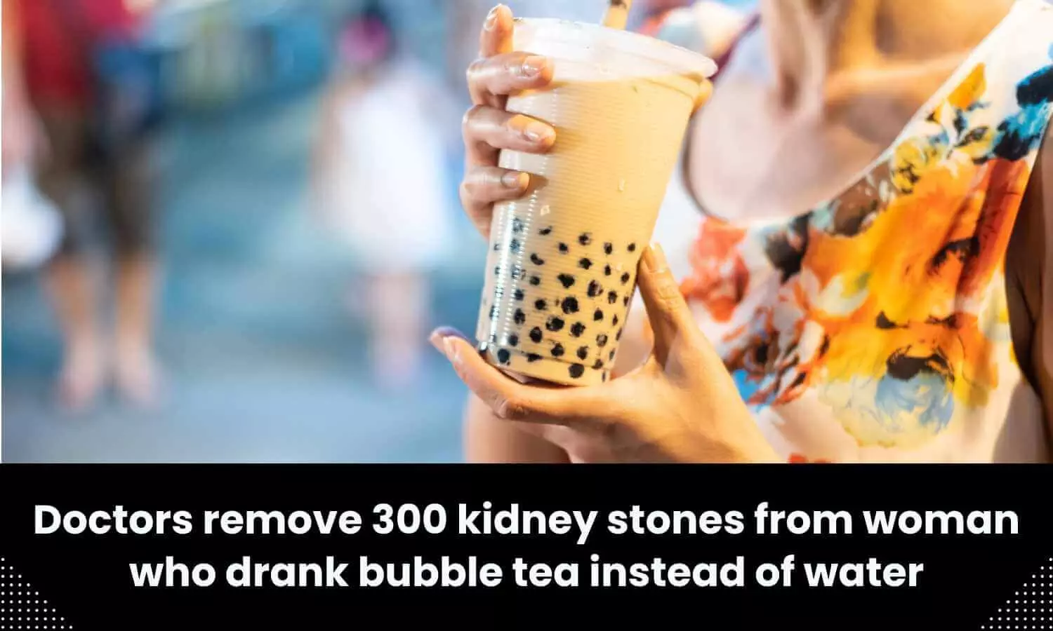 Doctors remove 300 kidney stones from woman who consumed bubble tea instead of water