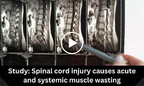 Study: Spinal cord injury causes acute and systemic muscle wasting