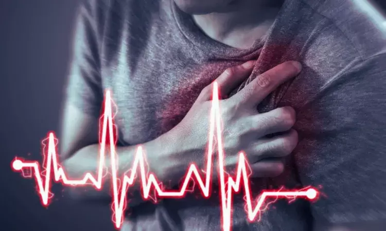 Study Unveils Novel ECG Marker for CRDS: Potential Breakthrough in Cardiac Arrest Diagnosis