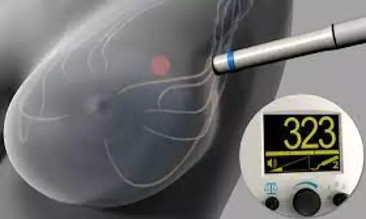 Totally magnetic technique effective option for sentinel lymph node detection and breast cancer localization