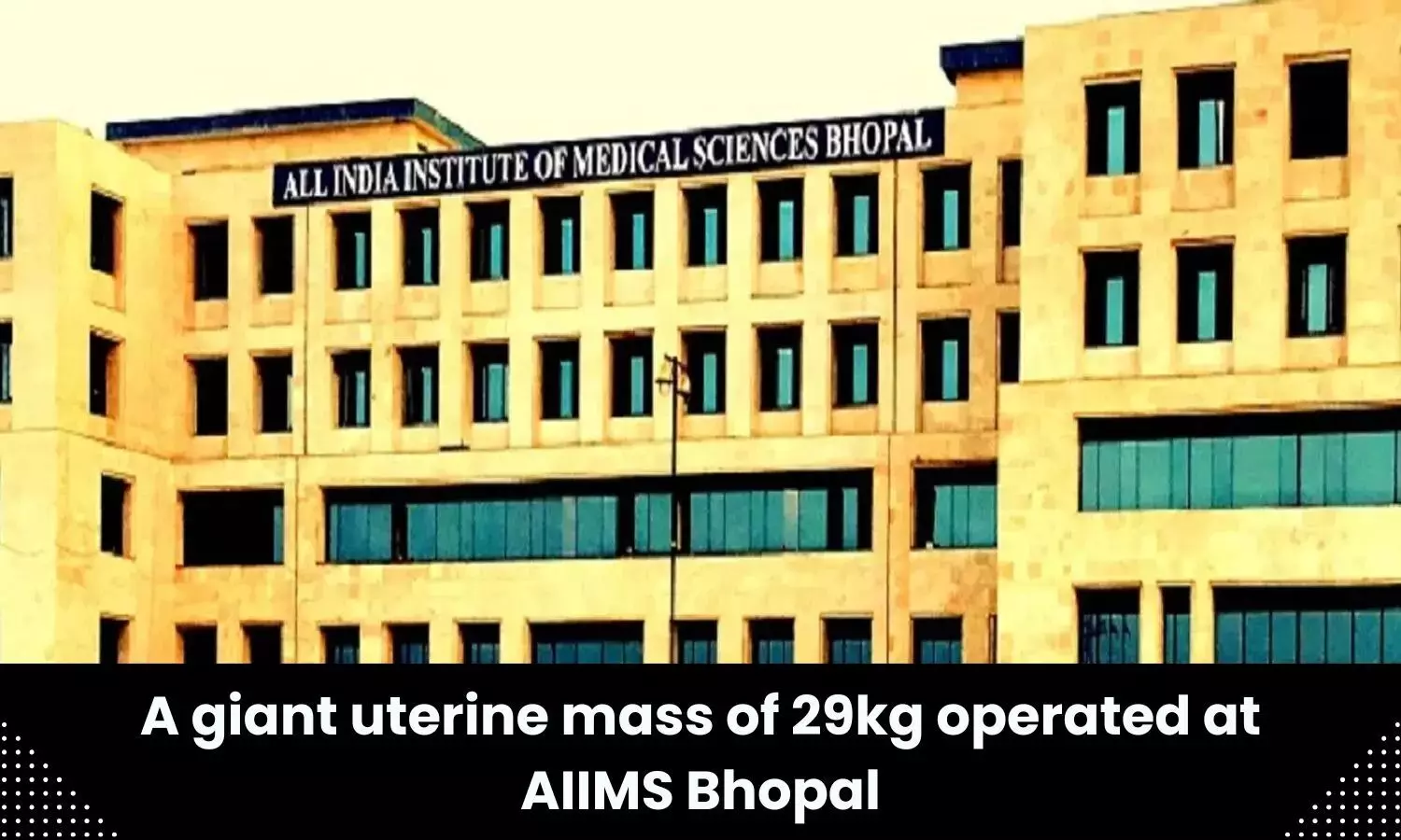 Giant uterine mass operated at AIIMS Bhopal