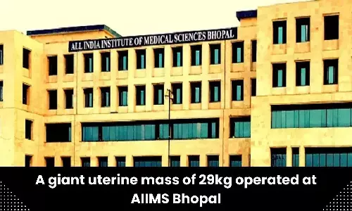 Giant uterine mass operated at AIIMS Bhopal