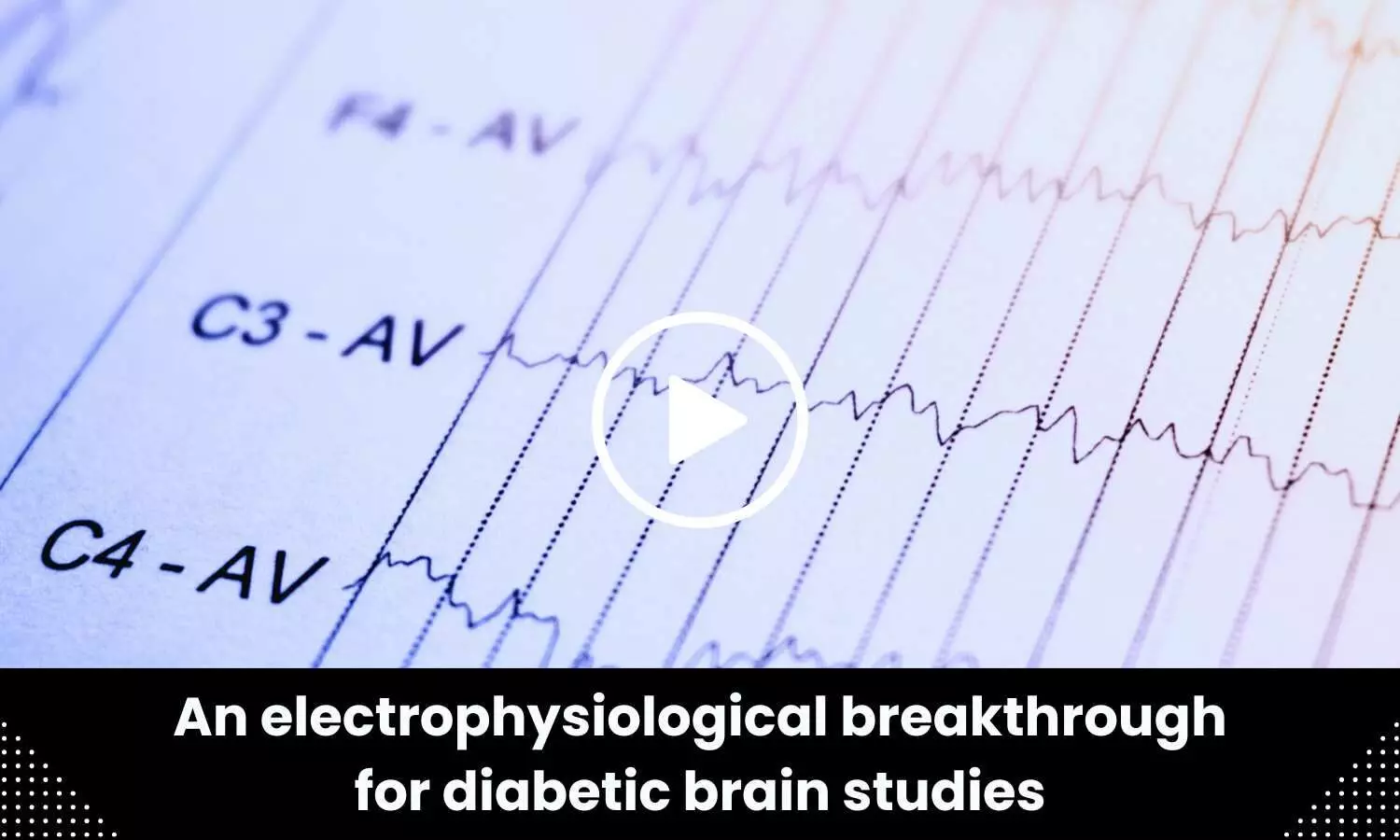 An electrophysiological breakthrough for diabetic brain studies
