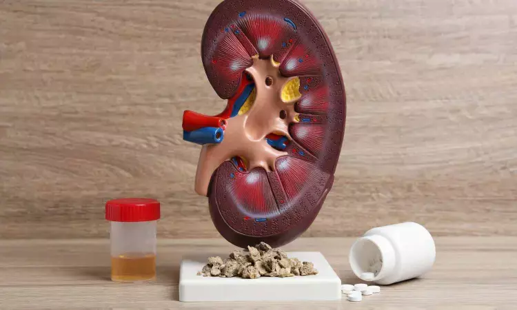 Alkaline water of no benefit for preventing kidney stones: Study