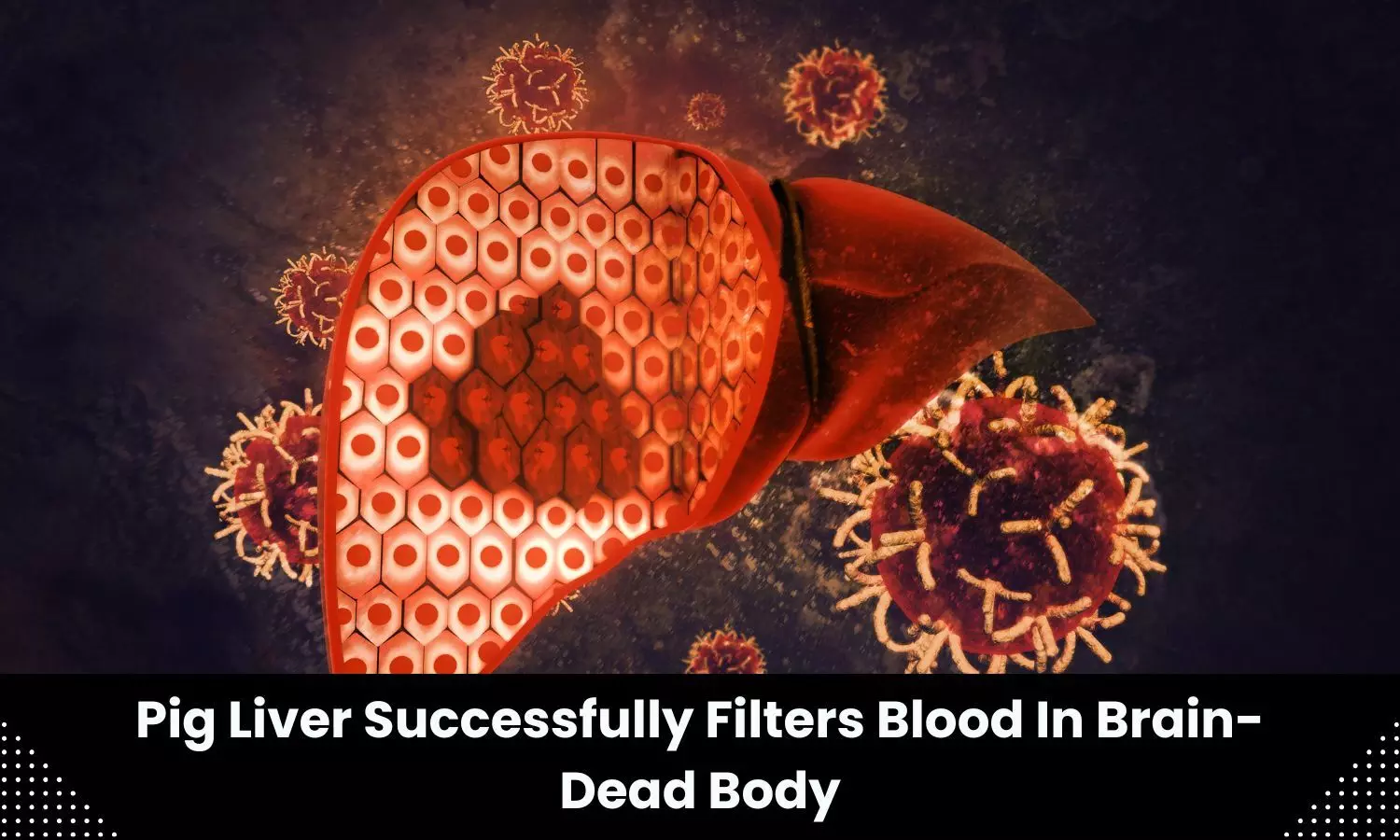 Pig liver successfully filters blood in brain-dead body