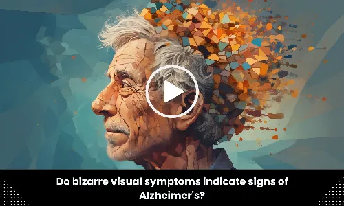 Bizarre visual symptoms may indicate signs of Alzheimers says study