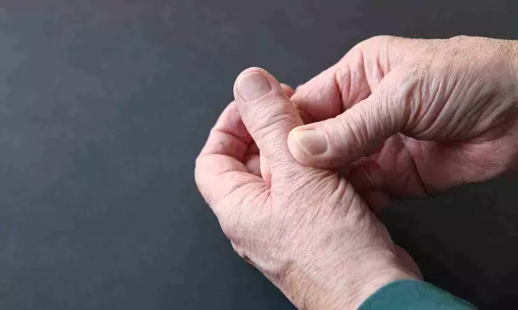 Weight Change Not Associated with Hand Osteoarthritis Progression and Pain
