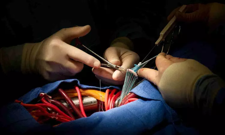 Guidewire during TAVR procedures appears to be efficacious and safe: Study