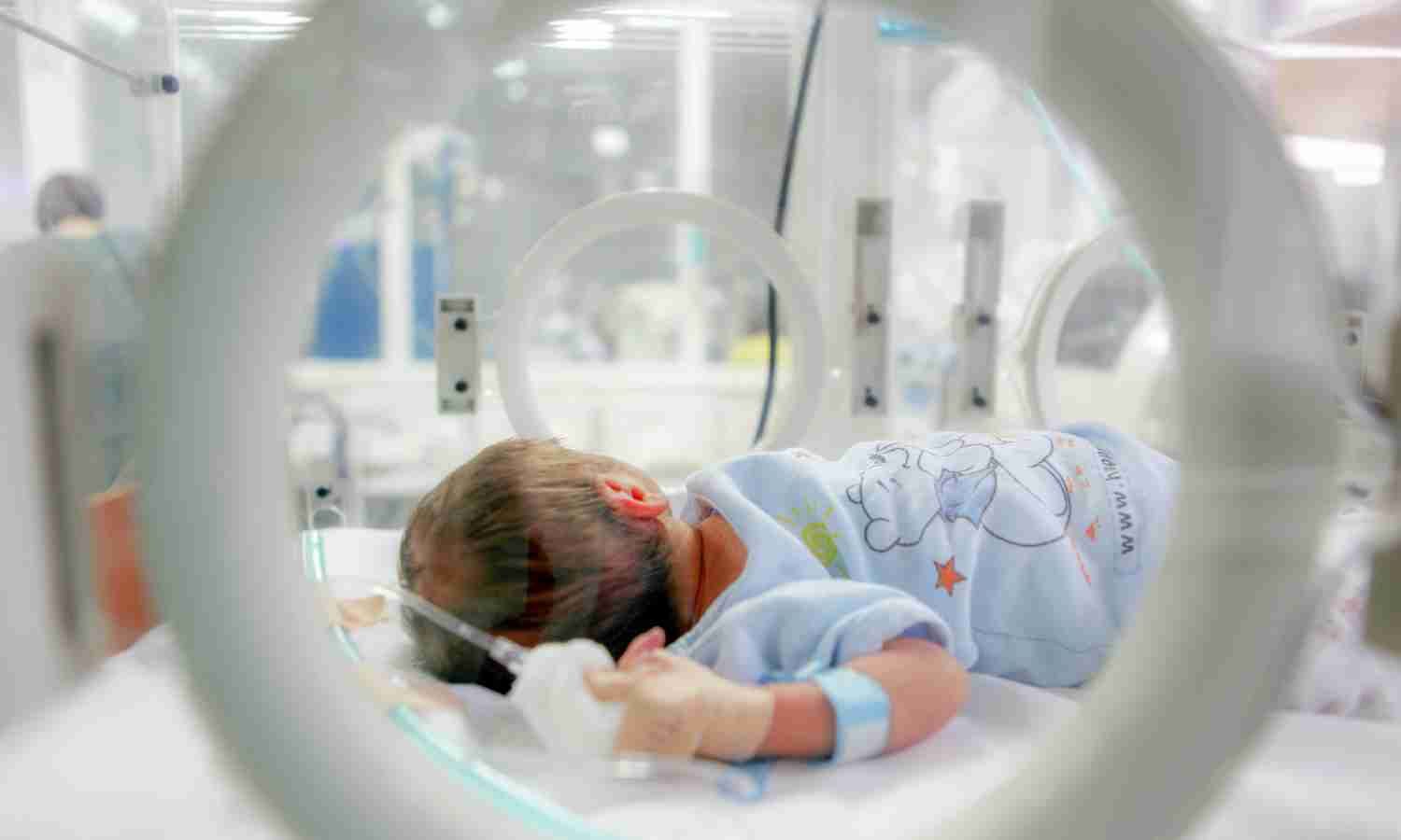 Pulmonary Surfactant Therapy Improves Outcomes in Neonatal Respiratory Distress Syndrome: Study