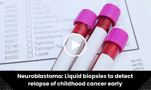 Liquid biopsies to detect Neuroblastoma relapse of childhood cancer early