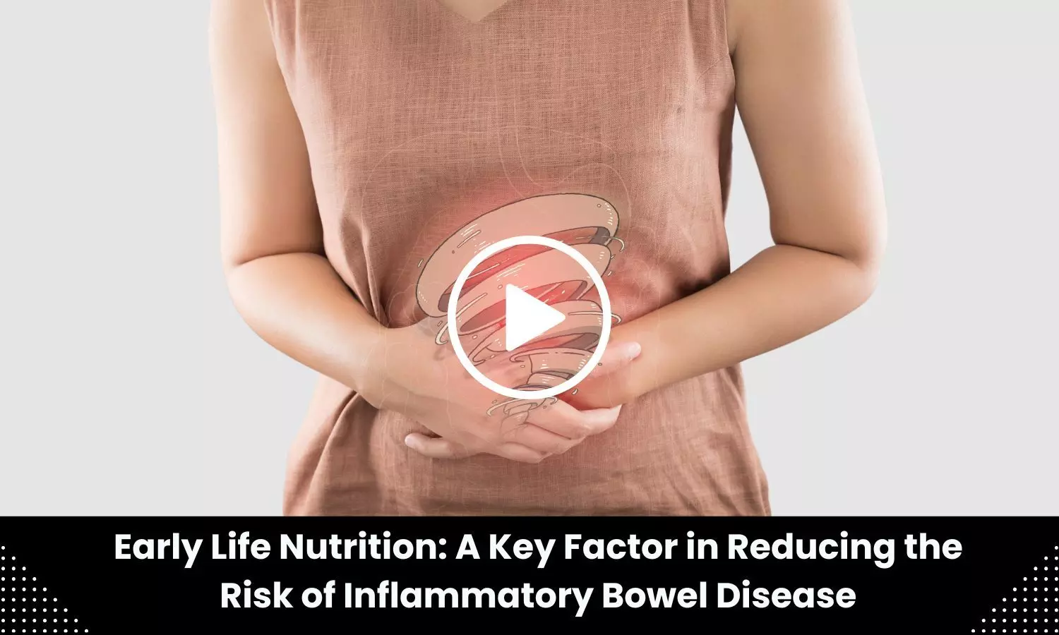 Early Life Nutrition: A Key Factor in Reducing the Risk of Inflammatory Bowel Disease