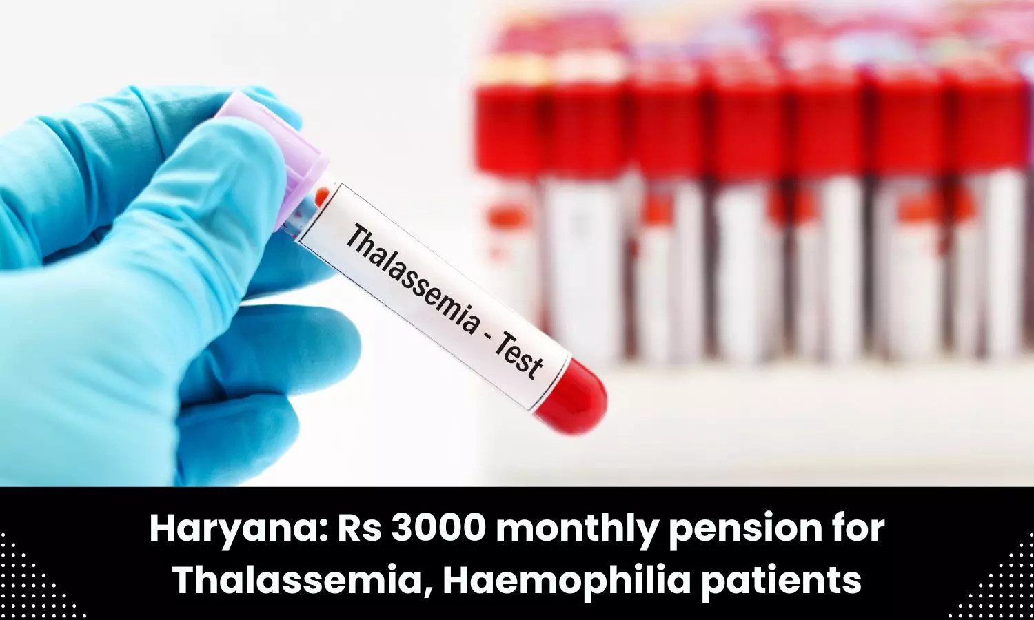 Patients of Thalassemia, Haemophilia in Haryana to get Rs 3000 monthly pension