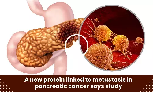 A new protein linked to metastasis in pancreatic cancer says study