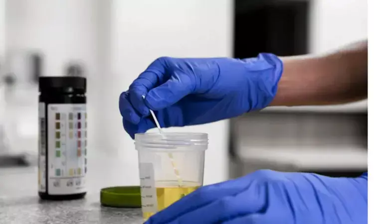 RaDPi-U, Promising fast and convenient technique for screening drugs in urine samples, reveals study