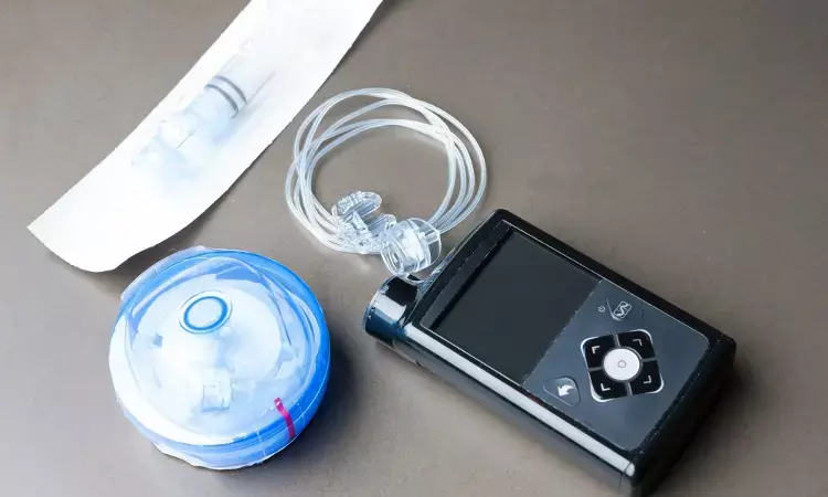 Home insulin pump use safe for hospitalized children with diabetes without active ketoacidosis