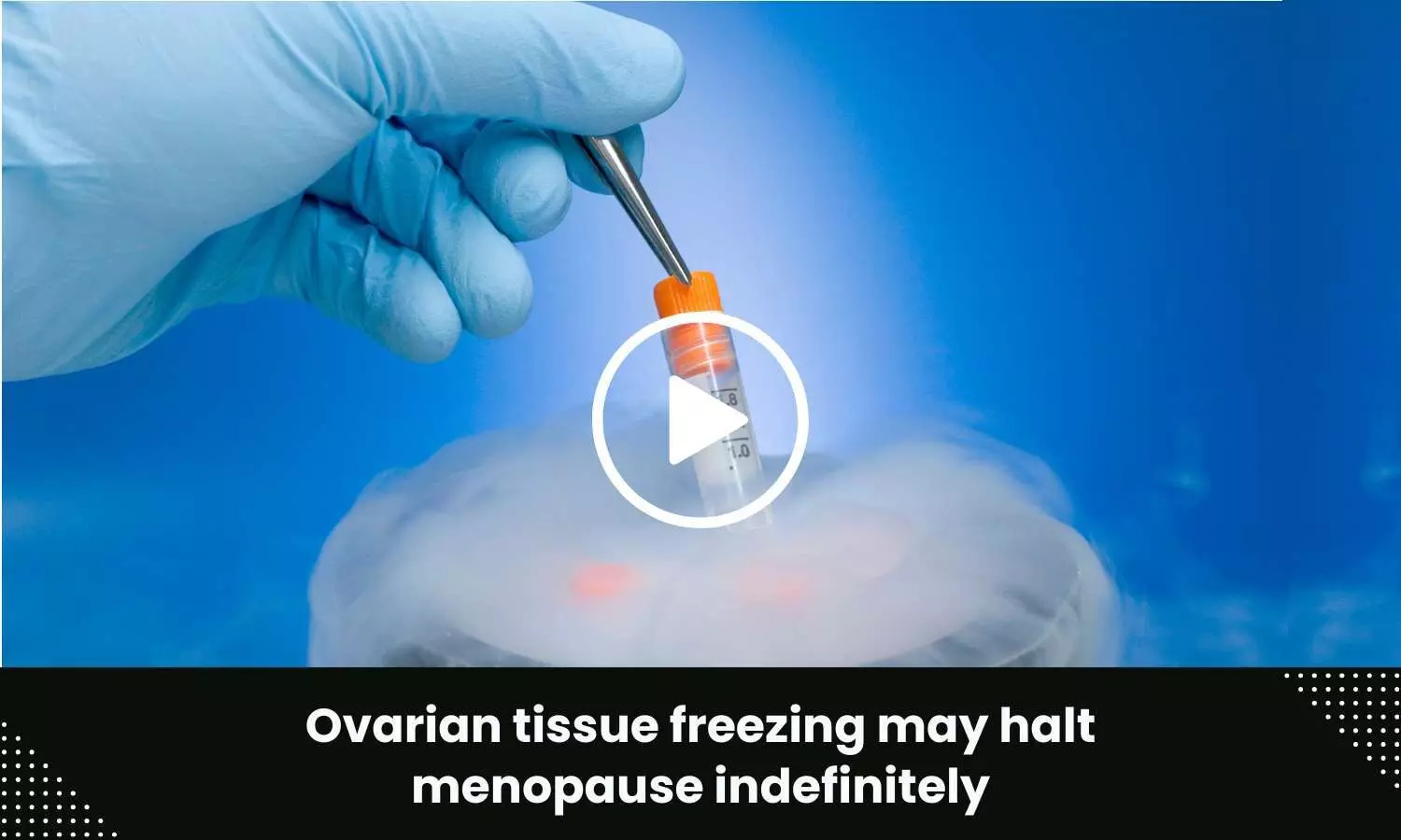 Ovarian tissue freezing may halt menopause indefinitely
