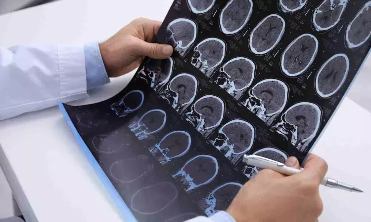 Visualising multiple sclerosis with a new MRI procedure