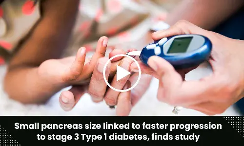 Small pancreas size linked to faster progression to stage 3 Type 1 diabetes, finds study
