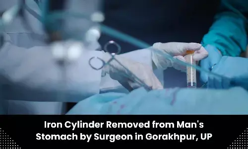 Two-foot iron cylinder found inside mans stomach, removed