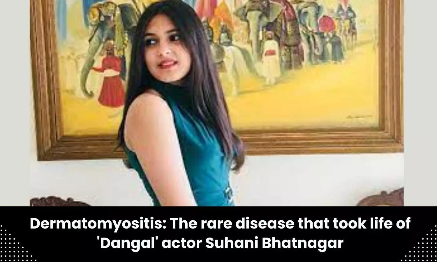 Dangal actor Suhani Bhatnagar dies of rare disease called Dermatomyositis