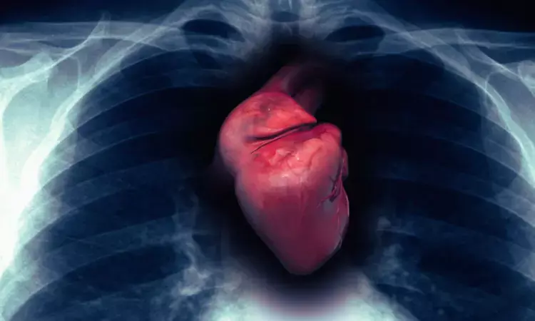 Novel risk score accurately predicts death without transplant in patients awaiting heart transplantation: JAMA