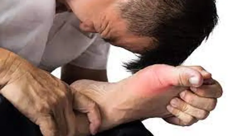 Depression may increase risk of gout: study