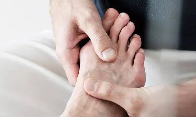 Patients with OSA at Greater risk of Gout, finds study