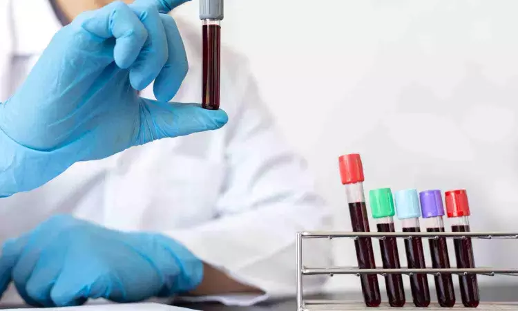 Scientists develop simple blood test to quickly diagnose sarcoidosis