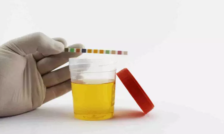 The rainbow of urine colors: Whats typical, whats not