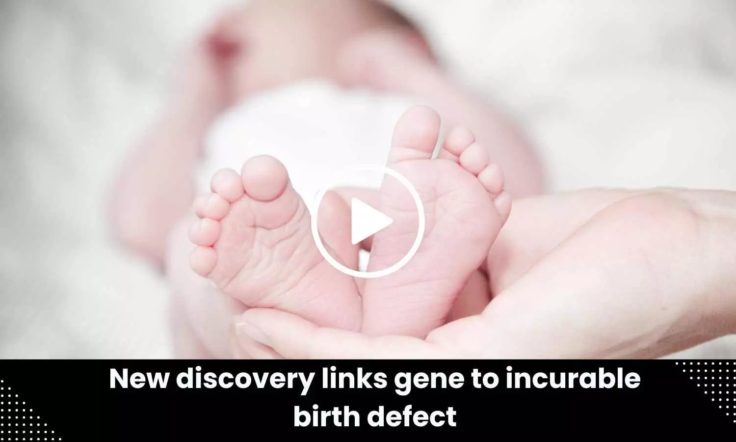 New discovery links gene to incurable birth defect