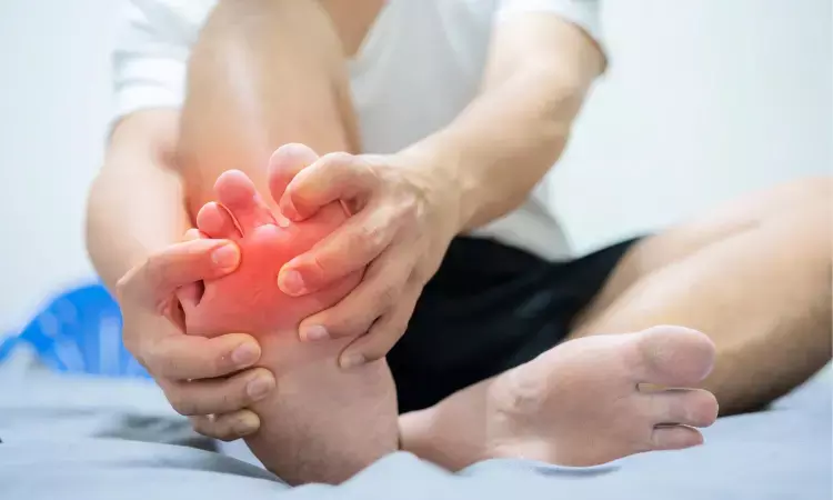 Breakthrough Study Reveals Rapid Reduction of Gout-Related Crystal Deposits with Pegloticase Therapy