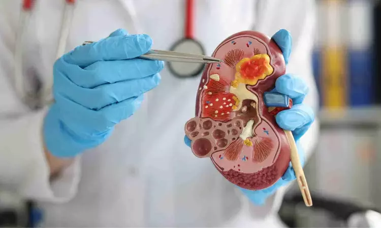 Simple measurement can predict risk of worsening of widespread kidney disease