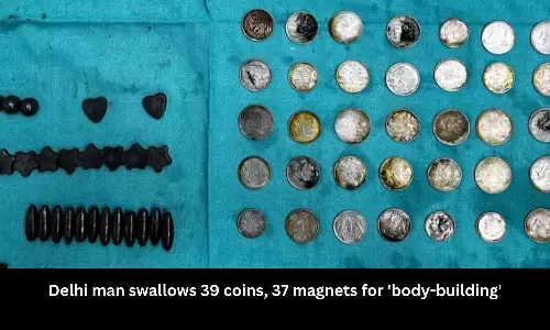 26-year-old man swallows 39 coins, 37 magnets for body building