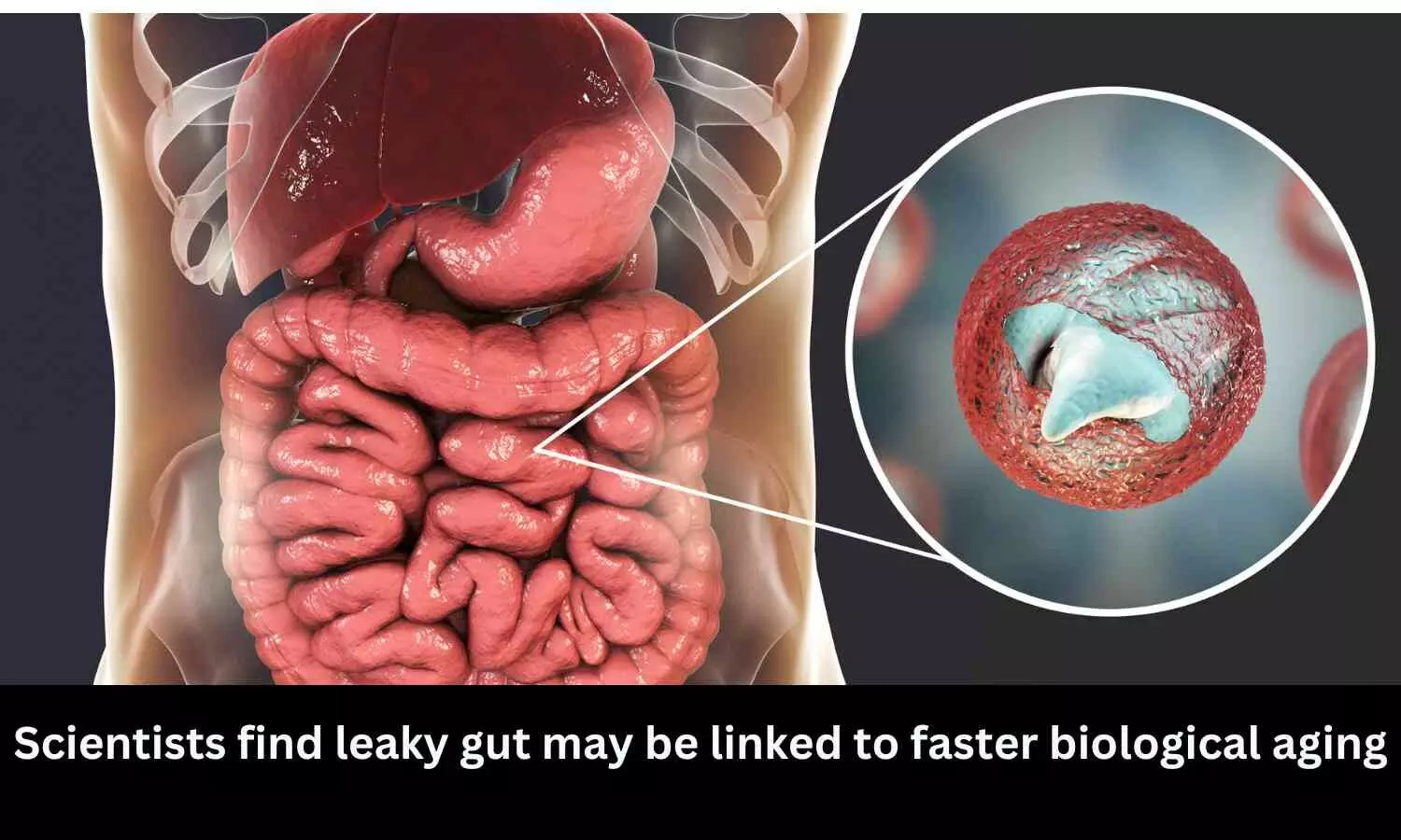 Scientists find leaky gut may be linked to faster biological aging