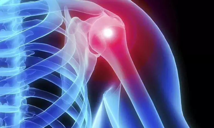 Pulsed radiofrequency on suprascapular and axillary-circumflex nerve effective for Shoulder pain relief: Study