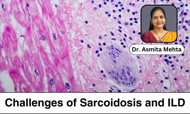 Shedding Light on the Dual Challenges of Sarcoidosis and ILD - Dr Asmita Mehta
