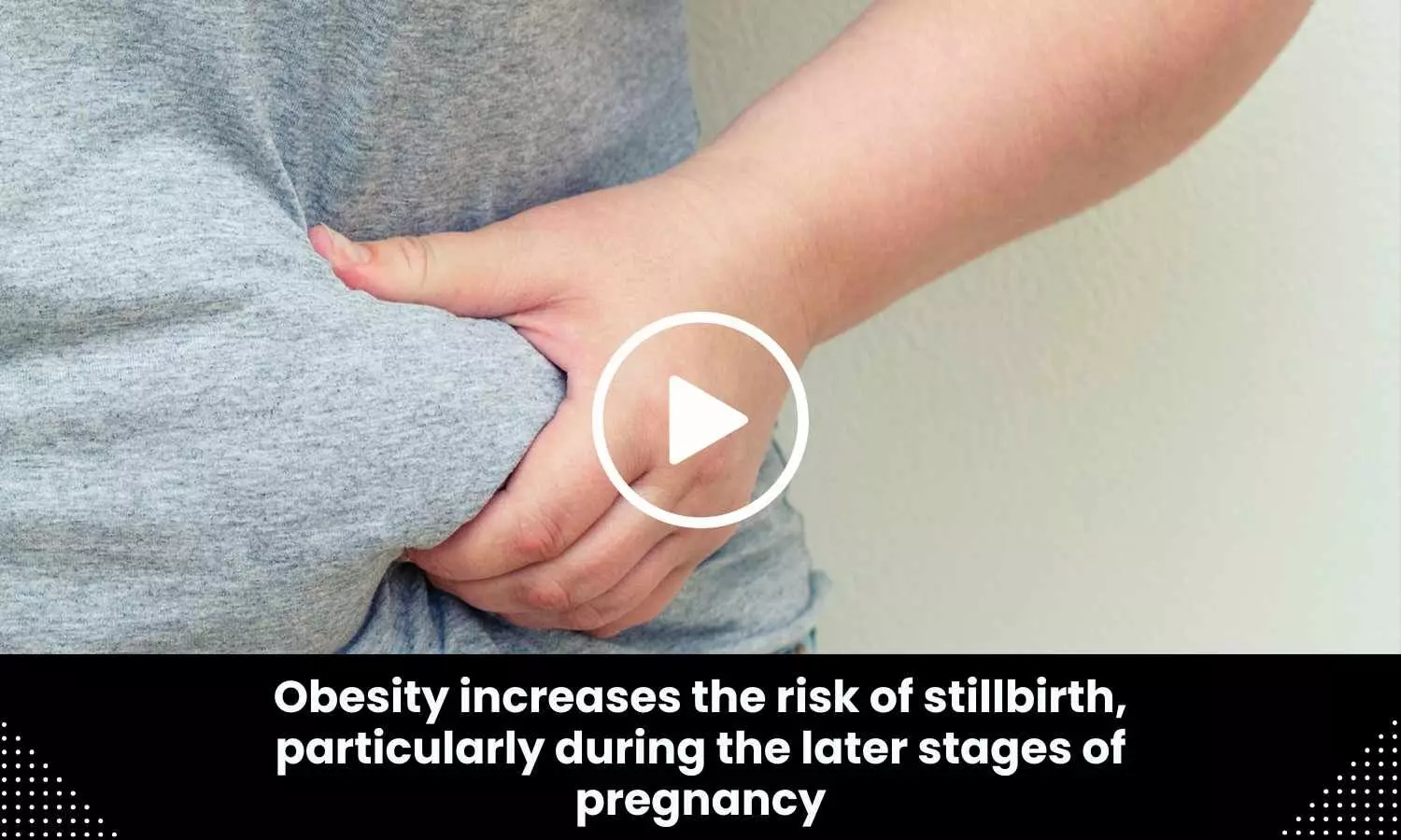 Obesity increases the risk of stillbirth, particularly during the later stages of pregnancy