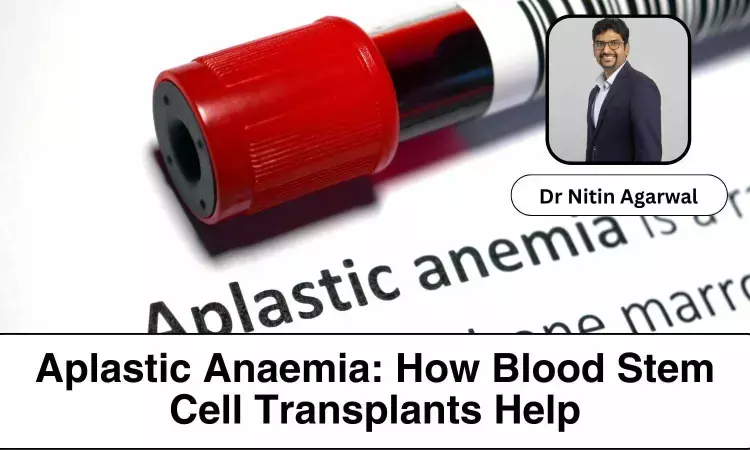 Aplastic Anaemia: How Blood Stem Cells Transplants Help - Dr Nitin Agarwal