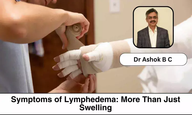Decoding Lymphedema: Symptoms, Diagnosis, and Proactive Solutions - Dr Ashok B C