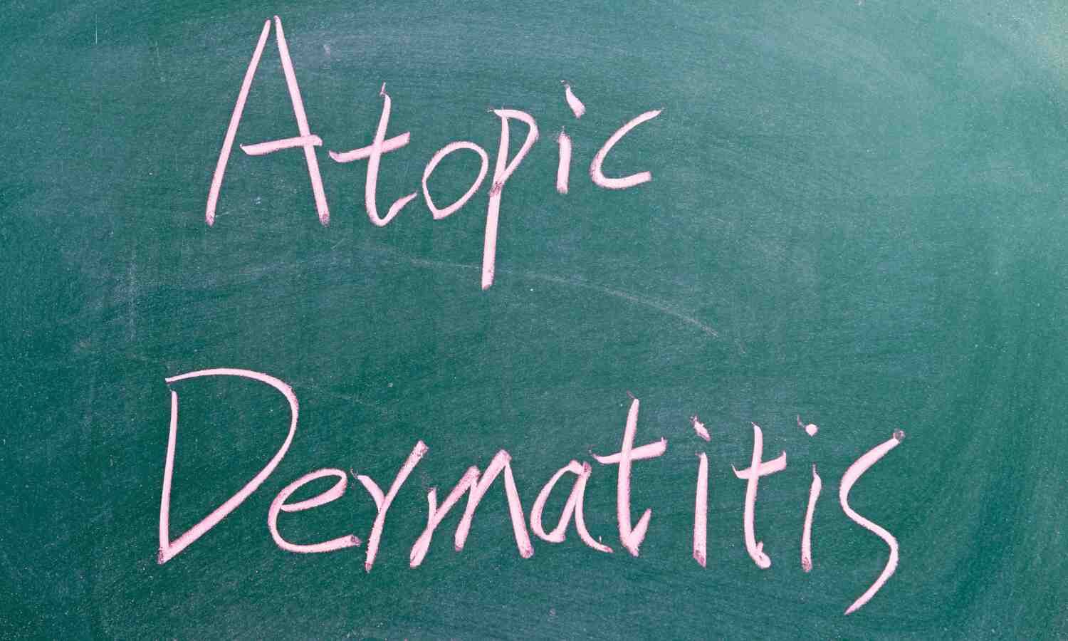 Rezpegaldesleukin Shows Sustained Benefit in Moderate-to-Severe Atopic Dermatitis in Phase 2 b trial